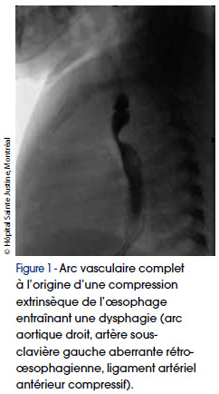 OESOPHAGE-ET-SES-MAUX-FIG1
