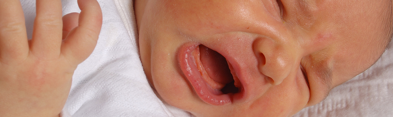 Le reflux gastro-oesophagien du nourrisson
